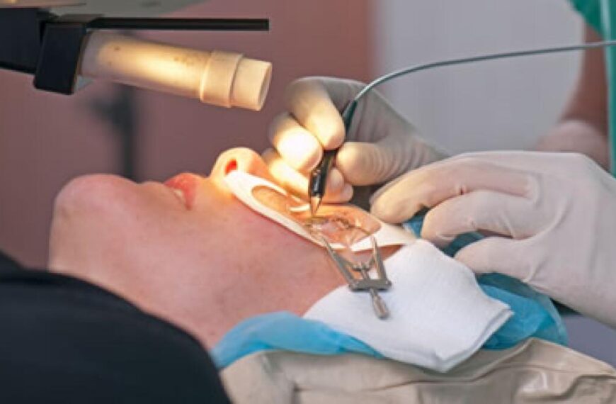 Refractive Surgery