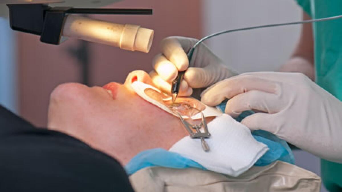 Refractive Surgery